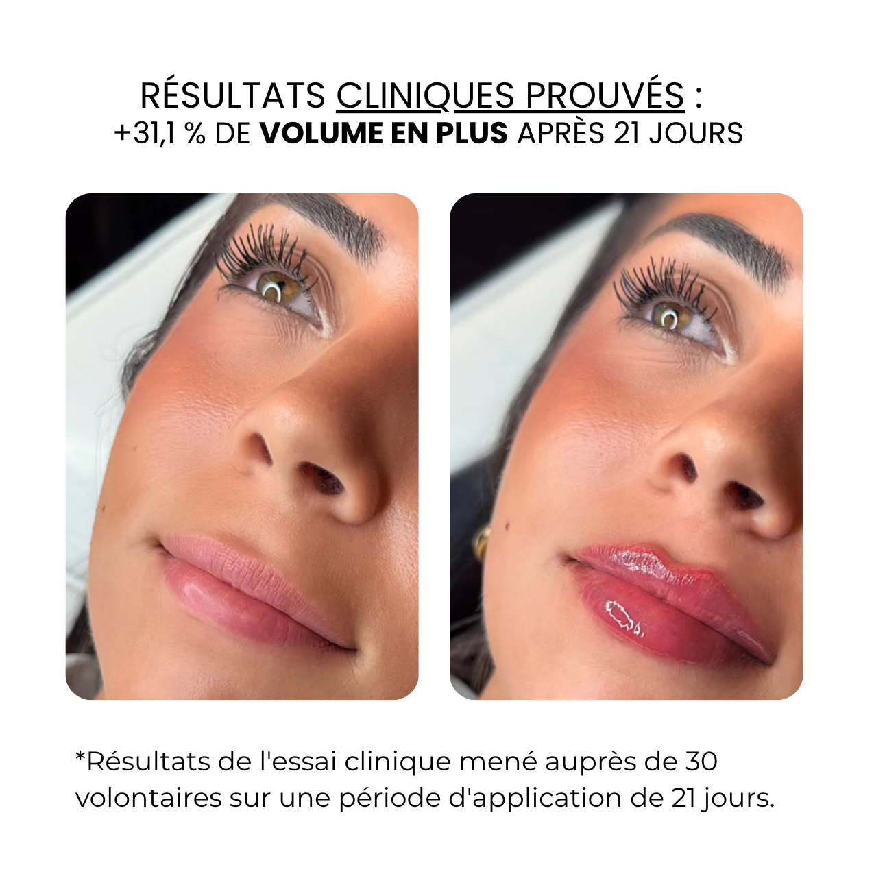 Traitement des lèvres | HAMINOS®
