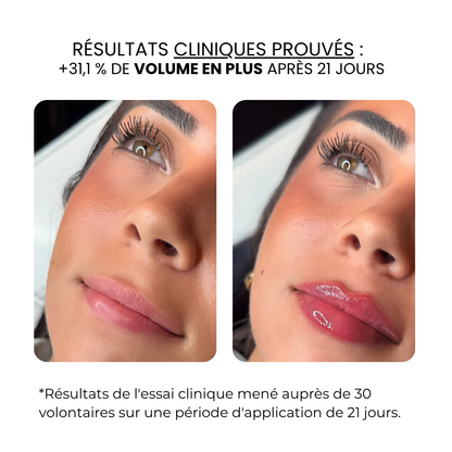Traitement des lèvres | HAMINOS®