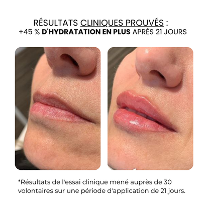 Traitement des lèvres | HAMINOS®