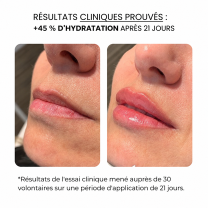 Soin des lèvres au derma roller