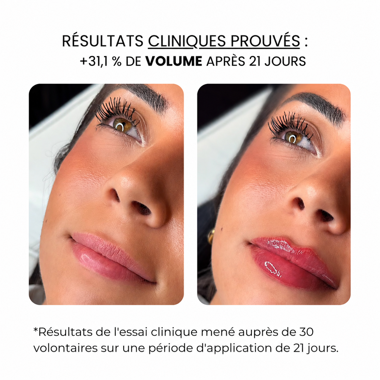 Soin des lèvres au derma roller