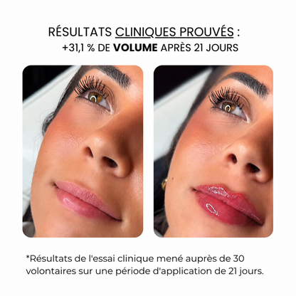 Soin des lèvres au derma roller